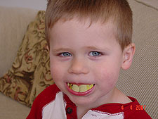 Hunter with his pirate teeth.